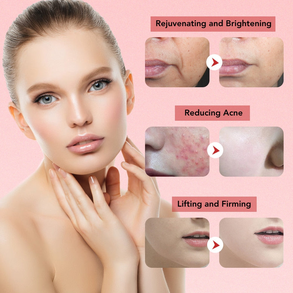 7 in 1 Microcurrent Skin Rejuvenation Facial Massager