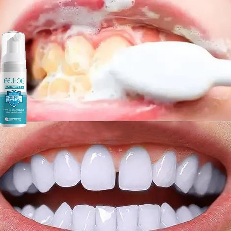 Hollywood Smile Micro Technology Foam - New for Shining Teeth.